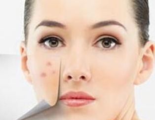 廈門哪家醫(yī)院墊鼻子好？專家推薦的Top5廈門墊鼻子好醫(yī)院