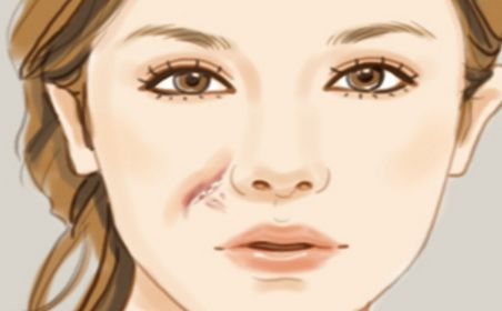 天津有哪些醫(yī)院的祛痘效果好？哪家醫(yī)院的祛痘效果最佳？