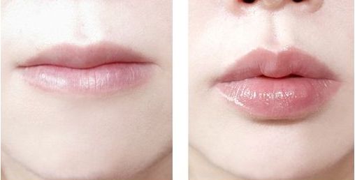 山東隱耳整形哪家醫(yī)院好？專業(yè)評(píng)測(cè)及患者真實(shí)分享