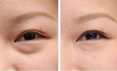 洛陽有減肥醫(yī)院哪家好？瘦身專家推薦幫您選擇洛陽最好的減肥醫(yī)院