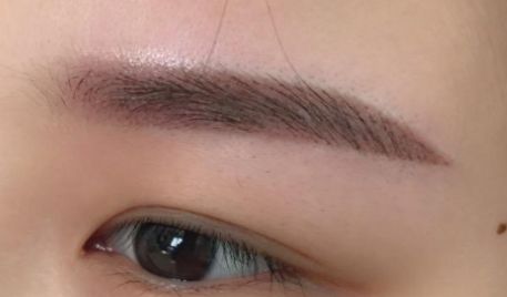 浙一醫(yī)院徐靖宏抽脂效果滿意嗎？有全新價(jià)格表嗎？