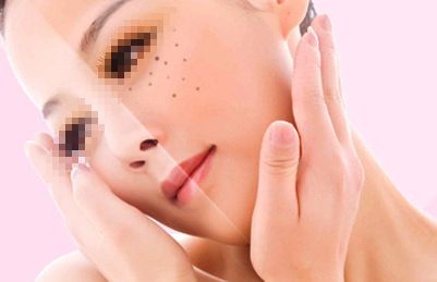 上海哪家專業(yè)醫(yī)院消除眼袋好