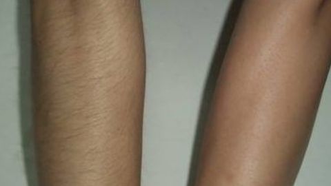 商丘杜韓整形醫(yī)院和華美之間如何選擇？雙眼皮手術(shù)價格一覽表