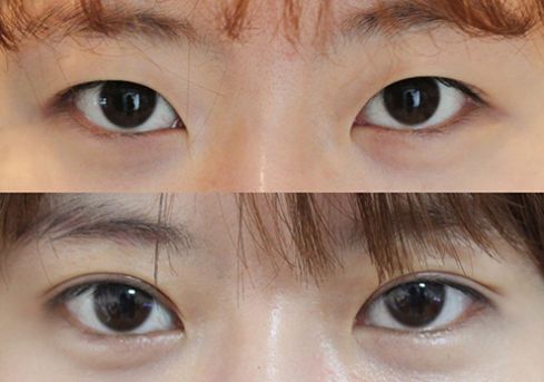 2023昆明生物基因除皺榜單十強(qiáng)醫(yī)生(金漢祚、何黎、張慶森口碑特色一一講解)