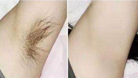 杭州藝星徐利剛醫(yī)生隆鼻項(xiàng)目靠譜嗎？技術(shù)操作曝光，口碑如何？