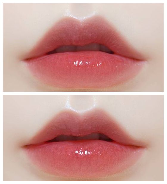 揭秘上海注射玻尿酸醫(yī)院排行榜，哪家好的口碑最高？