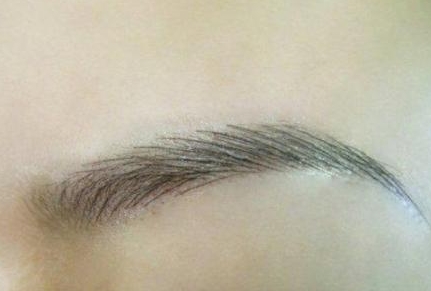 成都傅曉蓉醫(yī)院駐顏美容怎樣？重新定義令人驚嘆的專業(yè)整形效果