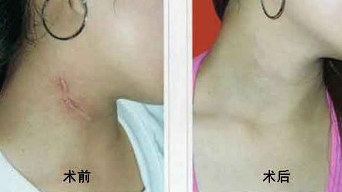 上海中西醫(yī)結(jié)合醫(yī)院整形美容科靠譜嗎？聽說口碑不錯！