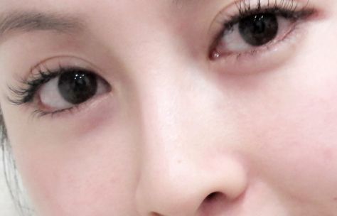 在烏魯木齊有哪些值得推薦的開(kāi)眼角好醫(yī)院？