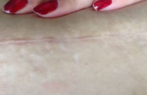 南京哪家醫(yī)院雙眼皮技術好？醫(yī)生經(jīng)驗豐富，效果一流！