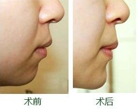 南寧整形豐胸醫(yī)院排名及評價互動：哪家醫(yī)院效果更好？