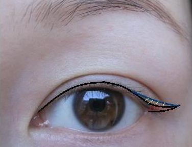 昆明哪家醫(yī)院專業(yè)祛除疤痕效果好？