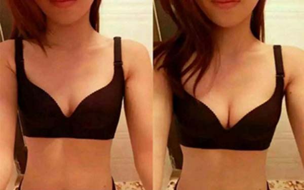 2023長春微針去靜態(tài)紋排行前10專家(佟建國、段圣楠、宣立豐口碑實力一一揭曉)