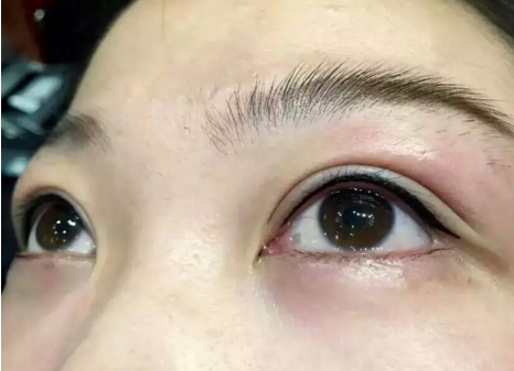 北京隆胸手術(shù)值得信賴的五位醫(yī)生，馮斌、翟紅宇等大咖給出推薦！