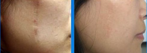 常州拇外翻醫(yī)院哪家醫(yī)院好？專家推薦，附詳細(xì)排名和患者口碑評(píng)論