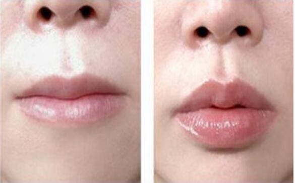 王連召醫(yī)師帶您探索北京八大處微創(chuàng)整容技術(shù)