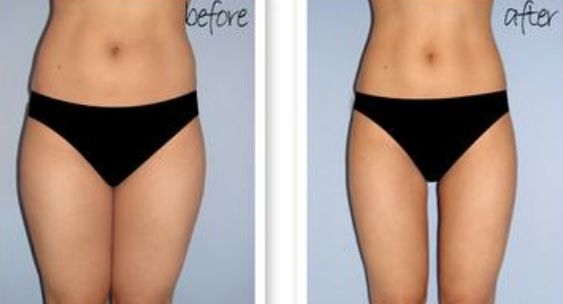 2023邯鄲音波拉皮面部除皺排行榜前10強(qiáng)的專家(高樹英、史慧萍、劉珠蓮收費(fèi)不貴)