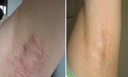 廈門祛雀斑醫(yī)院排名及口碑，哪家好？