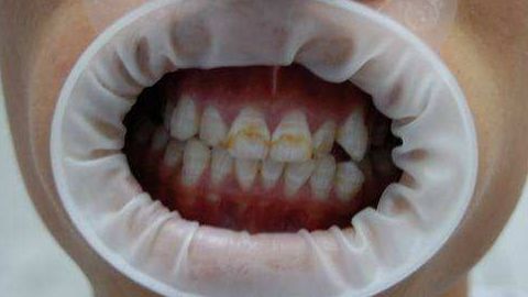 濰坊天宏整形醫(yī)院的口碑好嗎？張明欣技術(shù)擅長的具體內(nèi)容是什么？價目表在文末！