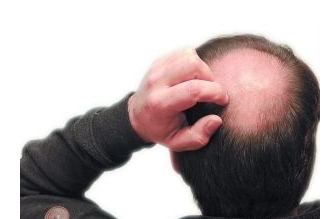 袁強(qiáng)拉皮除皺術(shù)的技術(shù)及年輕緊致效果，你知道嗎？