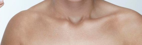 沈陽(yáng)墊鼻子醫(yī)院哪家好？墊鼻子手術(shù)效果怎么樣？