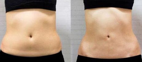 上海疤痕科醫(yī)院哪家好？綜合評測2023，含專家問答與真實患者見證