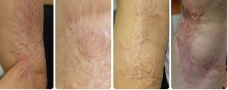 南京去紅血絲醫(yī)院專業(yè)推薦：哪家醫(yī)院技術(shù)高效、費(fèi)用合理？