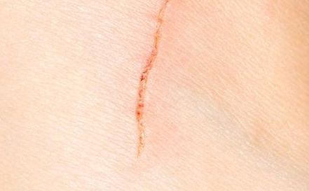 深圳去眼袋醫(yī)院哪家技術(shù)先進(jìn)，效果好