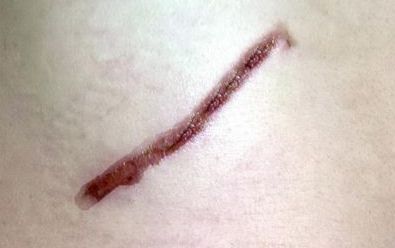 探尋開封市美容醫(yī)院的排名與口碑，哪家值得信賴？