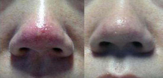 2023年浙江地區(qū)雙眼皮手術(shù)哪家醫(yī)院好，專(zhuān)屬權(quán)威排行榜