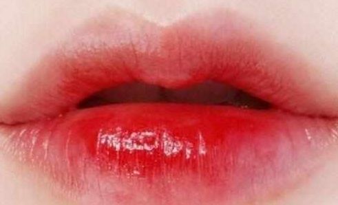 南寧祛疤整形哪家醫(yī)院最專業(yè)最受好評？