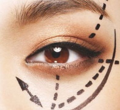 蘭州眼睛美容醫(yī)院哪家好？揭秘蘭州市最受歡迎的眼睛美容醫(yī)院排行榜！