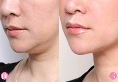 瀘州去疤痕哪家醫(yī)院好？疤痕修復(fù)盡在XXX?？漆t(yī)院！