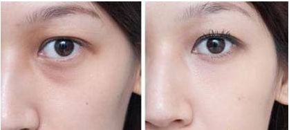 杭州哪家醫(yī)院做狐臭手術(shù)好且靠譜？