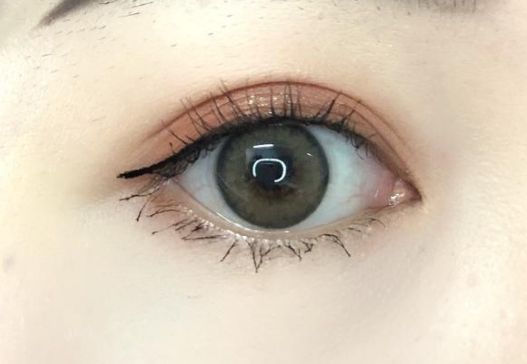 重慶去疤痕醫(yī)院有哪些專家？哪家去疤痕醫(yī)院好？