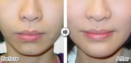 沈陽星美北順城醫(yī)療美容診所怎么樣？沈陽星美北順城醫(yī)療美容診所簡(jiǎn)介|醫(yī)生團(tuán)隊(duì)|口碑評(píng)價(jià)！