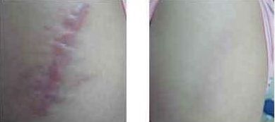 上海割眼袋哪家醫(yī)院靠譜？如何選擇上海割眼袋醫(yī)院？