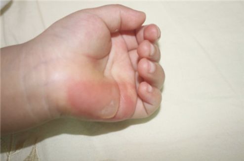 雙眼皮手術(shù)武漢哪家醫(yī)院好？熱門推薦及口碑解讀