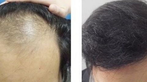 怡合醫(yī)院私密整形科有哪些資質(zhì)和口碑呢？