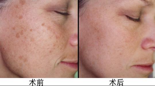 上海假體隆胸醫(yī)師推薦！王濤、亓發(fā)芝、劉天一帶您尋找完美曲線！