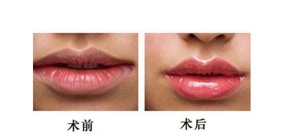 江蘇哪家醫(yī)院做激光祛斑好？