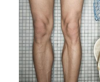 李楊西京醫(yī)院手術(shù)專家，助您完美小拉皮