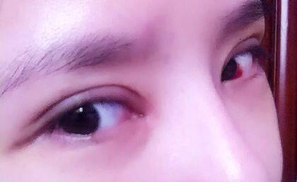 2023重慶做豐唇珠權(quán)威專(zhuān)家上榜前10名(吳偉、薛斌、趙小英反饋超級(jí)好)