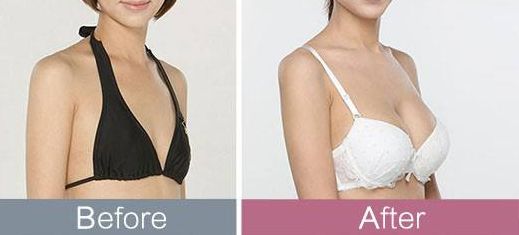 平頂山哪家醫(yī)院治療疤痕效果好且受用戶好評？