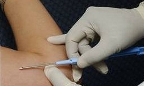 上海手術(shù)眼袋好的醫(yī)院有哪些？