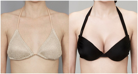 附去眼袋果圖，中心醫(yī)院邱曉東怎么樣治療效果如何