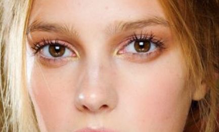 上海淡化雀斑的去哪家好？解析專家推薦的十大有效產(chǎn)品與方法