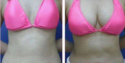 昆明哪家醫(yī)院的光子嫩膚祛斑效果好？