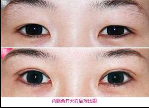 廊坊地區(qū)瘦臉針醫(yī)院排行榜2023：哪家醫(yī)院的瘦臉針效果好？