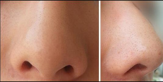 長沙鼻修復領(lǐng)域，哪位醫(yī)生口碑比較好的？五位知名專家匯總，推薦熱門醫(yī)師吳蒙！